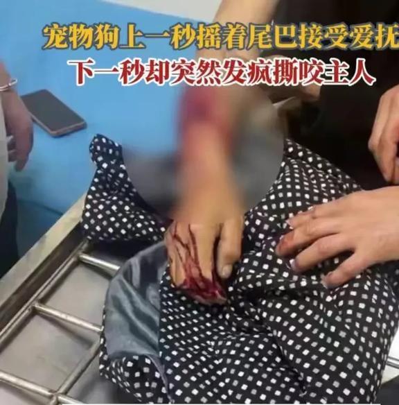 老人被养了四五年的狗撕咬 宠物驯养与责任引热议